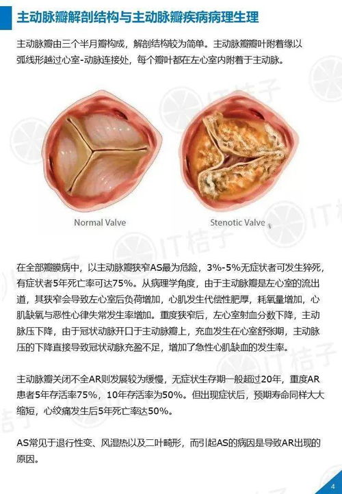 医疗器械投资正热,我们研究了国内外最值得关注的心脏瓣膜置换产品丨it桔子报告