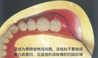 胡常红 全口义齿光滑面成型 本科技术班课程系列